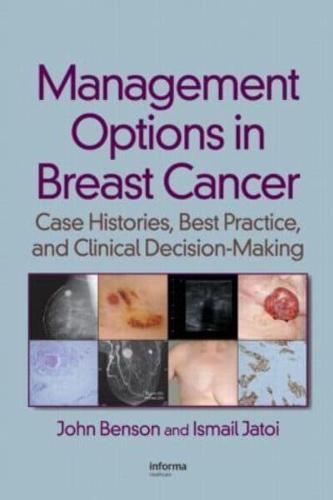 Management Options in Breast Cancer By:Jatoi, Ismail Eur:175,59 Ден1:8999
