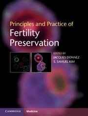 Principles and Practice of Fertility Preservation By:Donnez, Jacques Eur:95,92 Ден1:9299