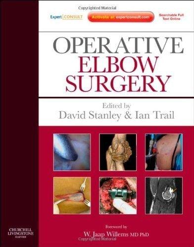 Operative Elbow Surgery : Expert Consult: Online and Print By:Stanley, David Eur:235,76  Ден3:14499