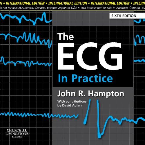 The ECG in Practice By:Hampton, John R Eur:43.89 Ден1:2999