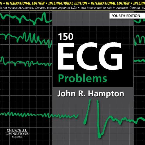 150 ECG Problems By:Hampton, John R Eur:222.75 Ден1:2699