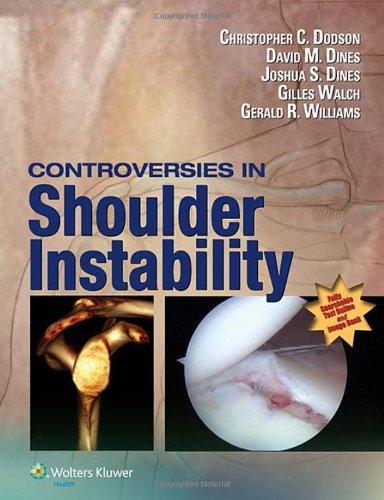 Controversies in Shoulder Instability By:Dodson, Christopher Eur:26 Ден1:14399