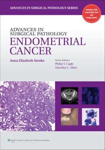 Advances in Surgical Pathology. Endometrial Cancer - Advances in Surgical Pathology By:Sienko, Anna Eur:95,92 Ден2:4199