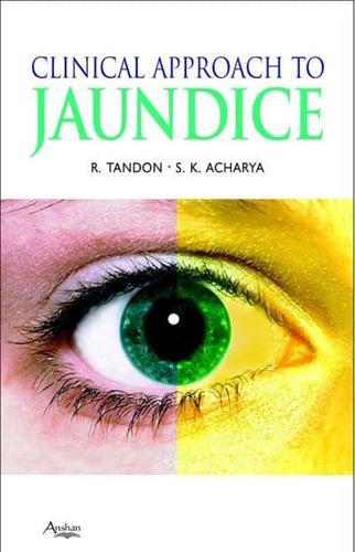 Clinical Approach to Jaundice By:Tandon, Rakesh Eur:81,28 Ден2:1299