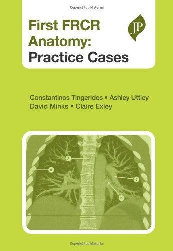 First FRCR Anatomy : Practice Cases By:Tingerides, Constantinos Eur:45,51 Ден1:2399