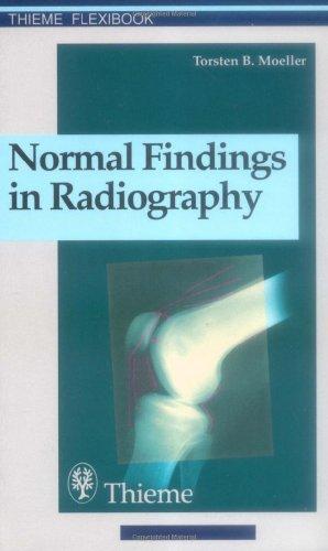 Normal Findings in Radiography : . Zus.-Arb.: Torsten B. Moeller Translated by Terry Telger 190 Illustrations By:Moeller, Torsten Bert Eur:45,51 Ден2:1399