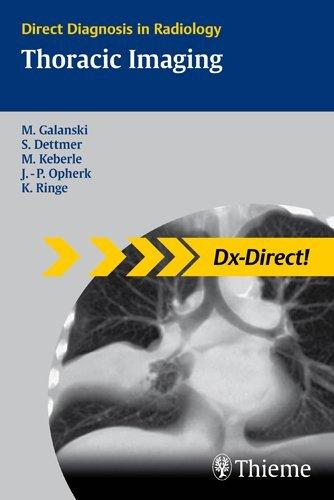 Thoracic Imaging By:Galanski, Michael Eur:199,98 Ден1:2899