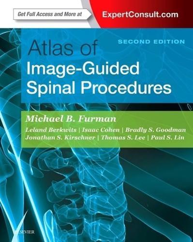 Atlas of Image-Guided Spinal Procedures By:(editor), Leland Berkwits Eur:308.93 Ден1:10399