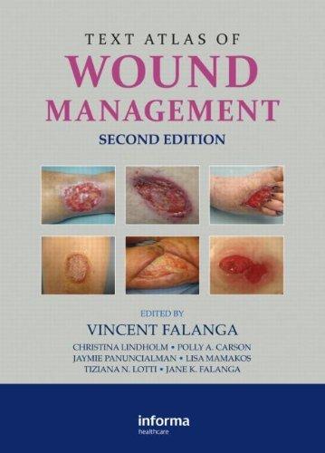 Text Atlas of Wound Management By:Falanga, Vincent Eur:40,63 Ден2:6999