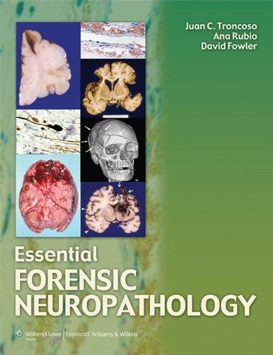 Essential Forensic Neuropathology By:Troncosco, Juan C. Eur:191,85  Ден3:11799