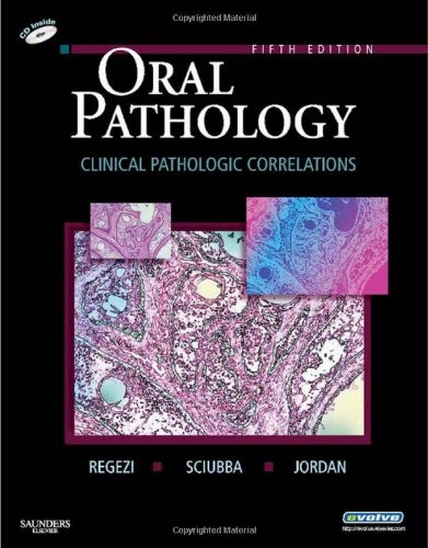 Oral Pathology, 5e By:Regezi Eur:40,63 Ден1:4899