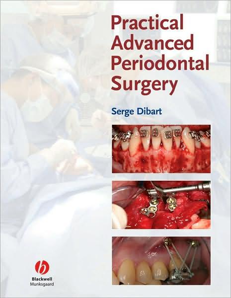 Practical Advanced Periodontal Surgery By: Eur:79,66 Ден1:2999