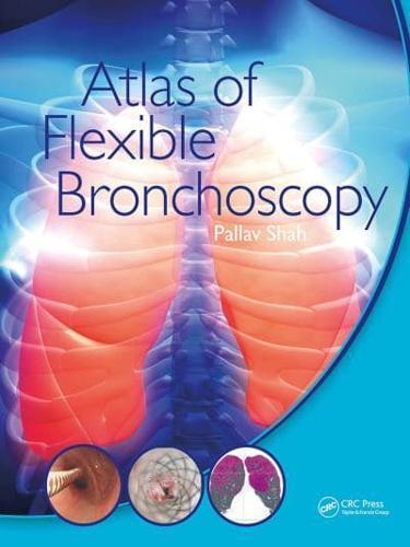 Atlas of Flexible Bronchoscopy By:Shah, Pallav Eur:16.24 Ден1:7199