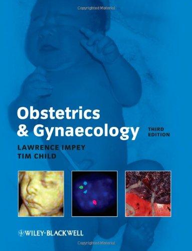 Obstetrics and Gynaecology By:Impey, Lawrence Eur:61,77 Ден1:2399