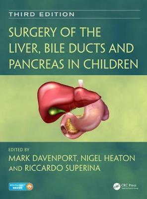 Surgery of the Liver, Bile Ducts and Pancreas in Children By:Davenport, Mark Eur:325,19 Ден2:17299