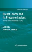 Breast Cancer and its Precursor Lesions By: Eur:4,88 Ден1:5799