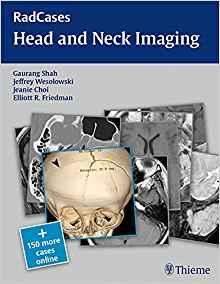 Radcases Head and Neck Imaging By:Shah, Gaurang Vrindavan ; Wesolowski, Jeffrey Robe Eur:56,89 Ден1:3599