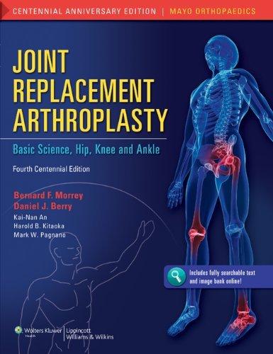 Joint Replacement Arthroplasty : Basic Science, Hip, Knee, and Ankle By:Morrey, Bernard F. Eur:183,72 Ден2:10899