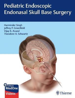 Pediatric Endoscopic Endonasal Skull Base Surgery By:Singh, Harminder Eur:47,14 Ден1:8699