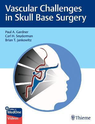 Vascular Challenges in Skull Base Surgery By:Gardner, Paul Eur:56,89 Ден1:8299