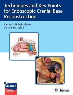 Techniques and Key Points for Endoscopic Cranial Base Reconstruction By:Pinheiro-Neto, Carlos Eur:325,19 Ден1:8799