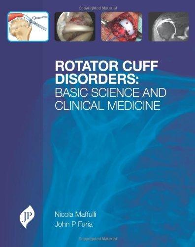 Rotator Cuff Disorders: Basic Science & Clinical Medicine By:Nicola, M.D., Ph.D. Maffulli Eur:183,72 Ден1:5199