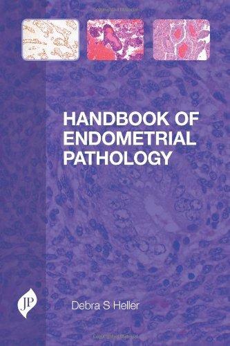 Handbook of Endometrial Pathology By:Heller, Debra S. Eur:121,93 Ден1:2599