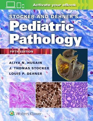 Stocker and Dehner's Pediatric Pathology By:Husain, Aliya N. Eur:40,63 Ден1:21899