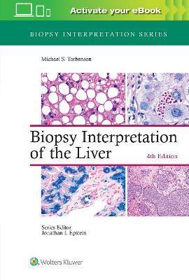 Biopsy Interpretation of the Liver By:Torbenson, Michael Eur:164.21  Ден3:10099