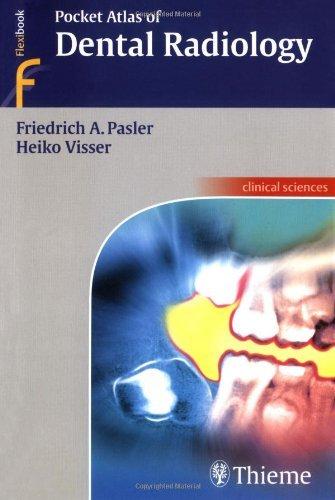 Pocket Atlas of Dental Radiology By:Pasler, Friedrich Anton Eur:24,37 Ден2:2399