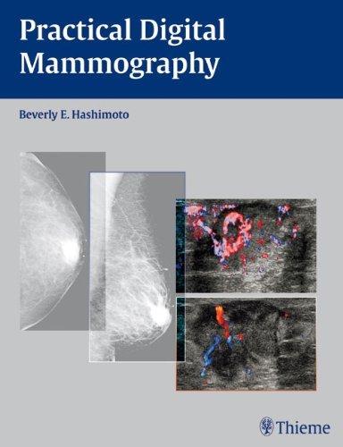 Practical Digital Mammography By:Hashimoto, Beverly Eur:12,99 Ден1:2099