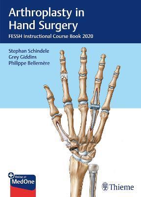 Arthroplasty in Hand Surgery : FESSH Instructional Course Book 2020 By:Schindele, Stephan Eur:154,46 Ден1:9099