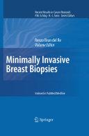 Minimally Invasive Breast Biopsies By: Eur:100,80 Ден2:2799