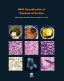 WHO Classification of Tumours of the Eye By: Eur:82,91  Ден3:5099